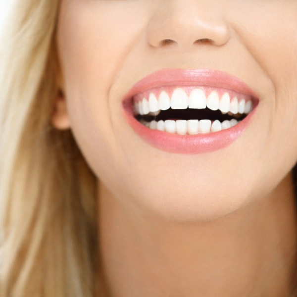 /hollywood-smile/