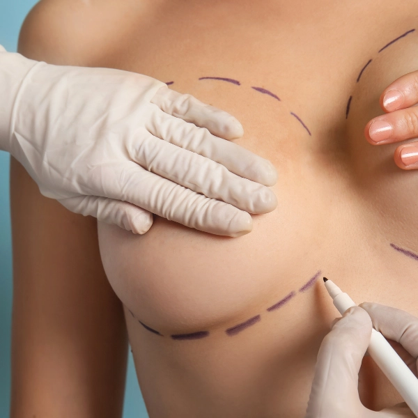 /breast-reduction/